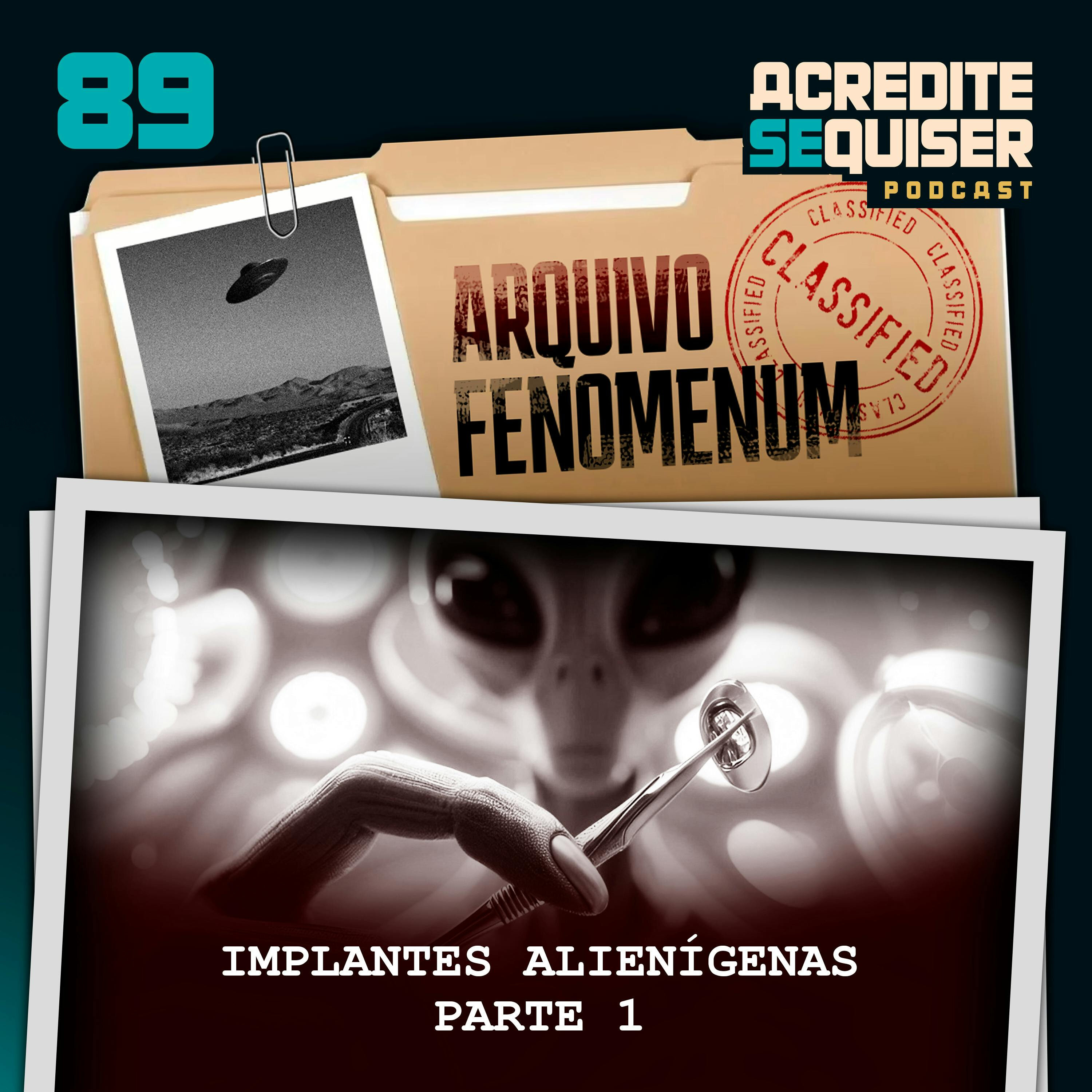 89 - Implantes Alienígenas - Parte 1
