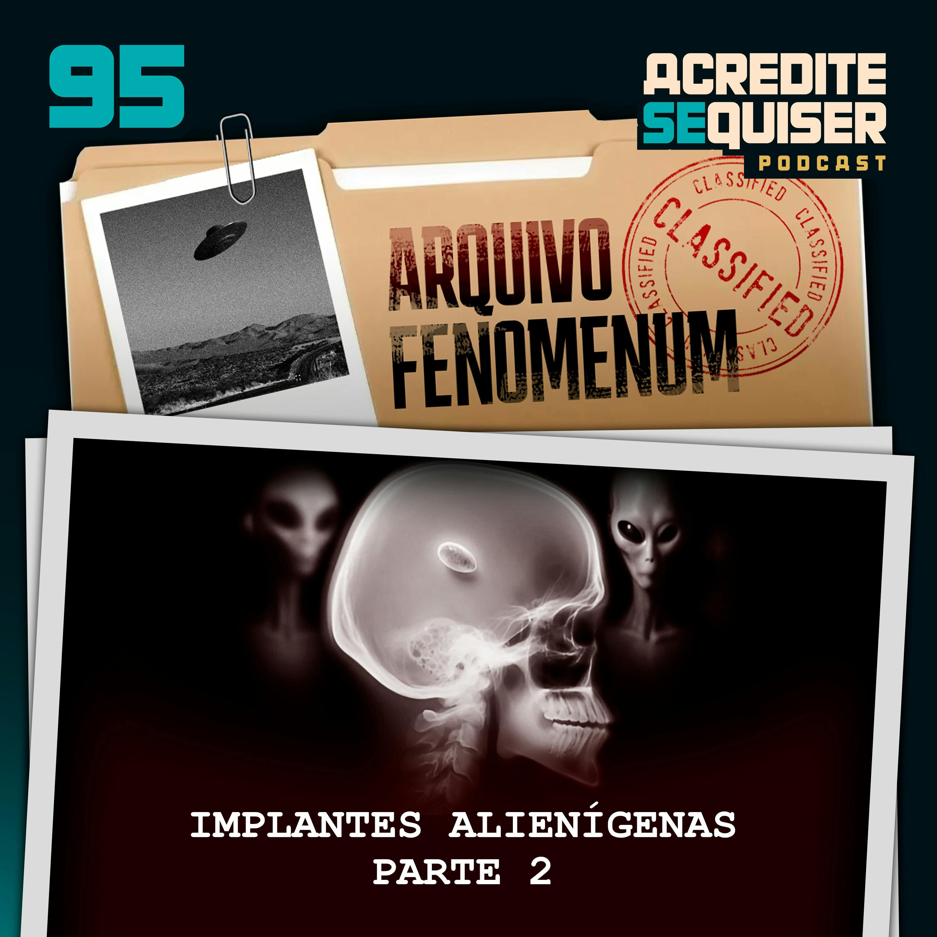 95 - Implantes Alienígenas - Parte 2
